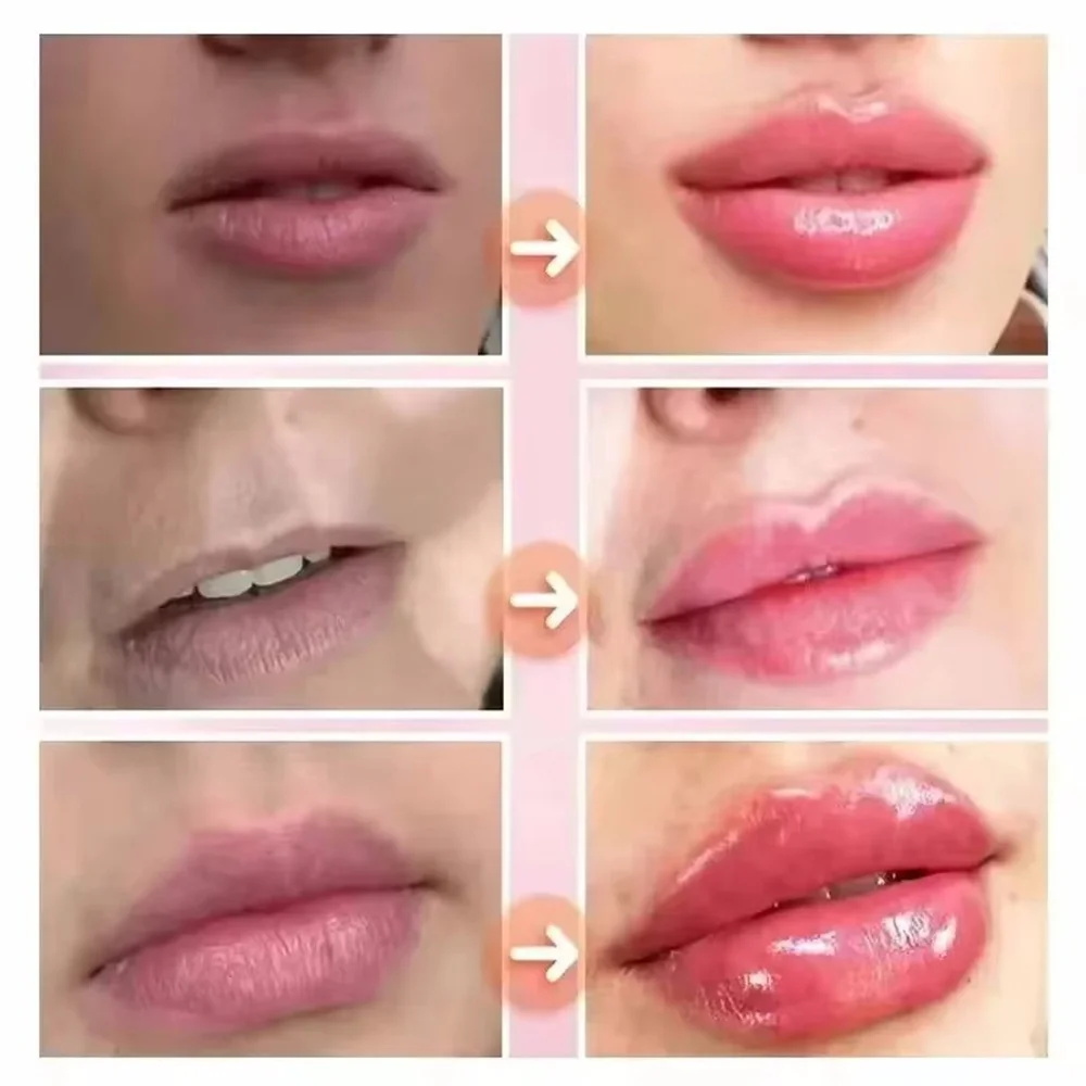 패스트 플럼핑 립밤 모이스춰라이징 소프트 립스 스킨 플 - Skincare Natur E 리뷰 및 가격