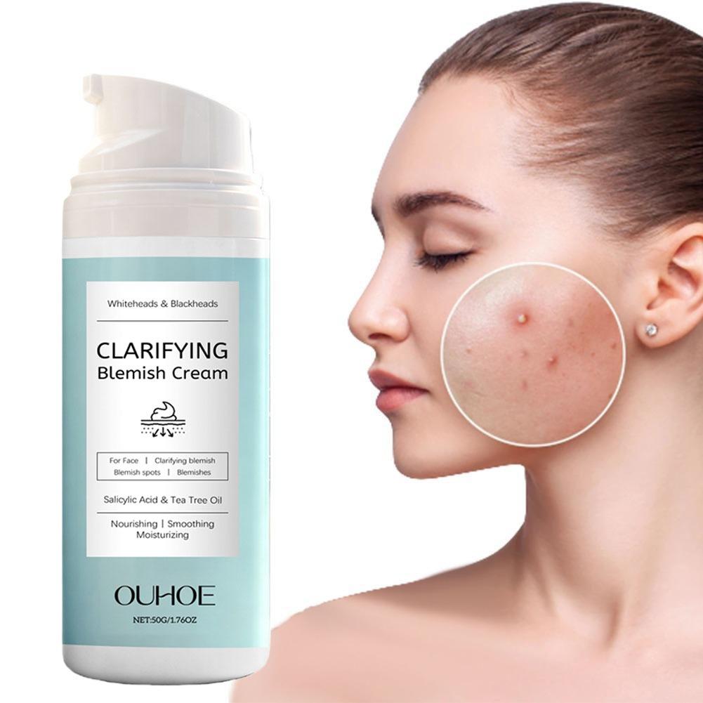 여드름 피부용 살리실산 페이셜 크림, 유분 조절, 진정 - Azelaic Acid Cream 리뷰 및 가격